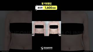 상체 부해보이던 느낌 진짜 많이 없어짐✨