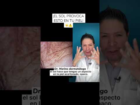 THE SUN CAUSES THIS TO YOUR SKIN. #dermatologist #doctor #tan #facialwrinkles #skincancer