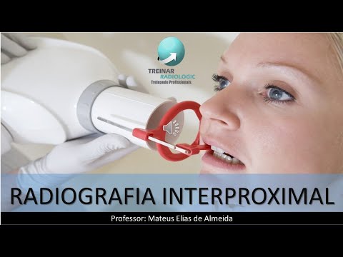 RADIOGRAFIA INTERPROXIMAL