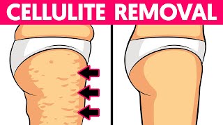 5 Ways to Remove Leg Cellulite Fast