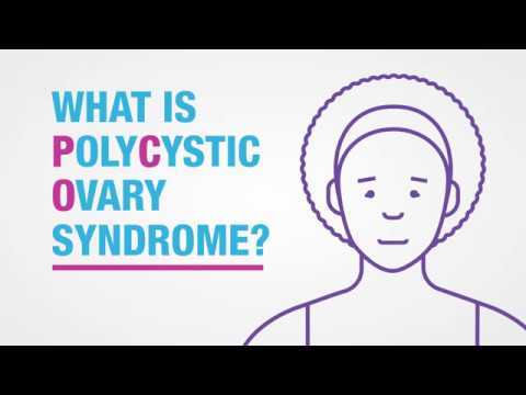 Polycystic Ovary Syndrome (PCOS) Symptoms