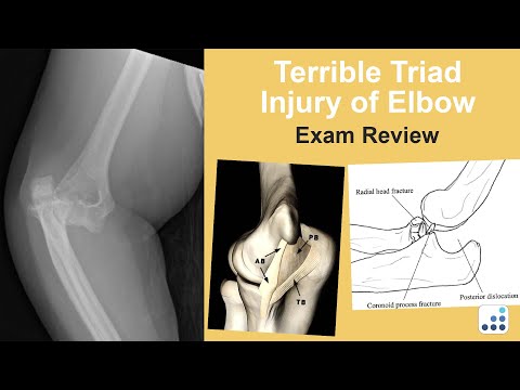 Terrible Triad Injury of Elbow Exam Review - Mark S. Cohen, MD