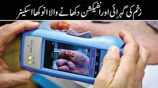 New wonder diagnosis handheld medical scanner 800 times more sensitive than full measure scanners