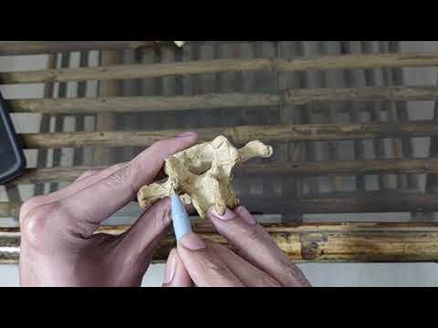 Lumbar Vertebrae Pedicle Screws