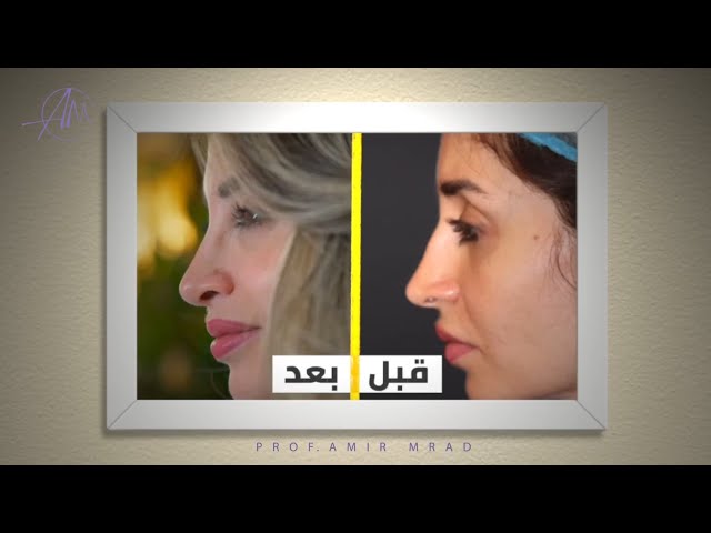 حجز استشارة إلكترونية مع البروفيسور أمير مراد