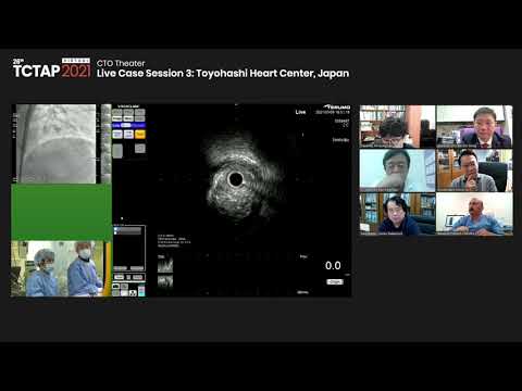 [TCTAP 2021 Virtual]CTO Theater - Live Case Session 3: Toyohashi Heart Center,Japan
