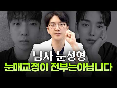 남자눈성형눈매교정, 쌍꺼풀 없이 눈매교정만 해도 될까?ㅣ디에이성형외과ㅣ남자눈성형무쌍눈매교정