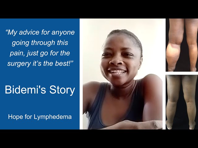 Hope for Lymphedema: Bidemi's Story