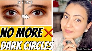 Remove DARK CIRCLES Permanently In 7 Days | 100% Results