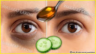 Home Remedies To Remove Dark Circles Under Eyes In 3 Days | How To Remove Dark Circles Naturally