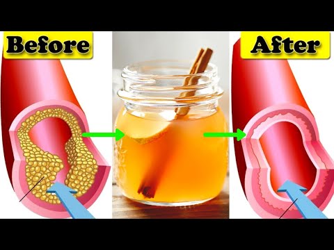 Only a Glass of This Juice will Remove Clogged Arteries And Control Blood Pressure