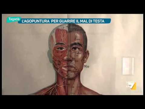 Ernie chirurgia intervertebrali Potenza per la struttura comune