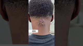 Say goodbye to folliculitis, scalp ringworm, and seborrheic dermatitis with Amanda Shampoo!