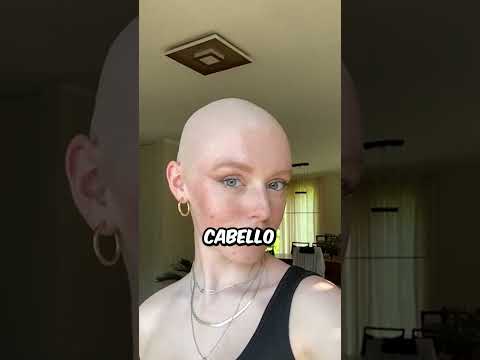 Famosos que hicieron el ridiculo en el escenario #tonyfranco