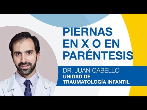 Piernas en x o en paréntesis