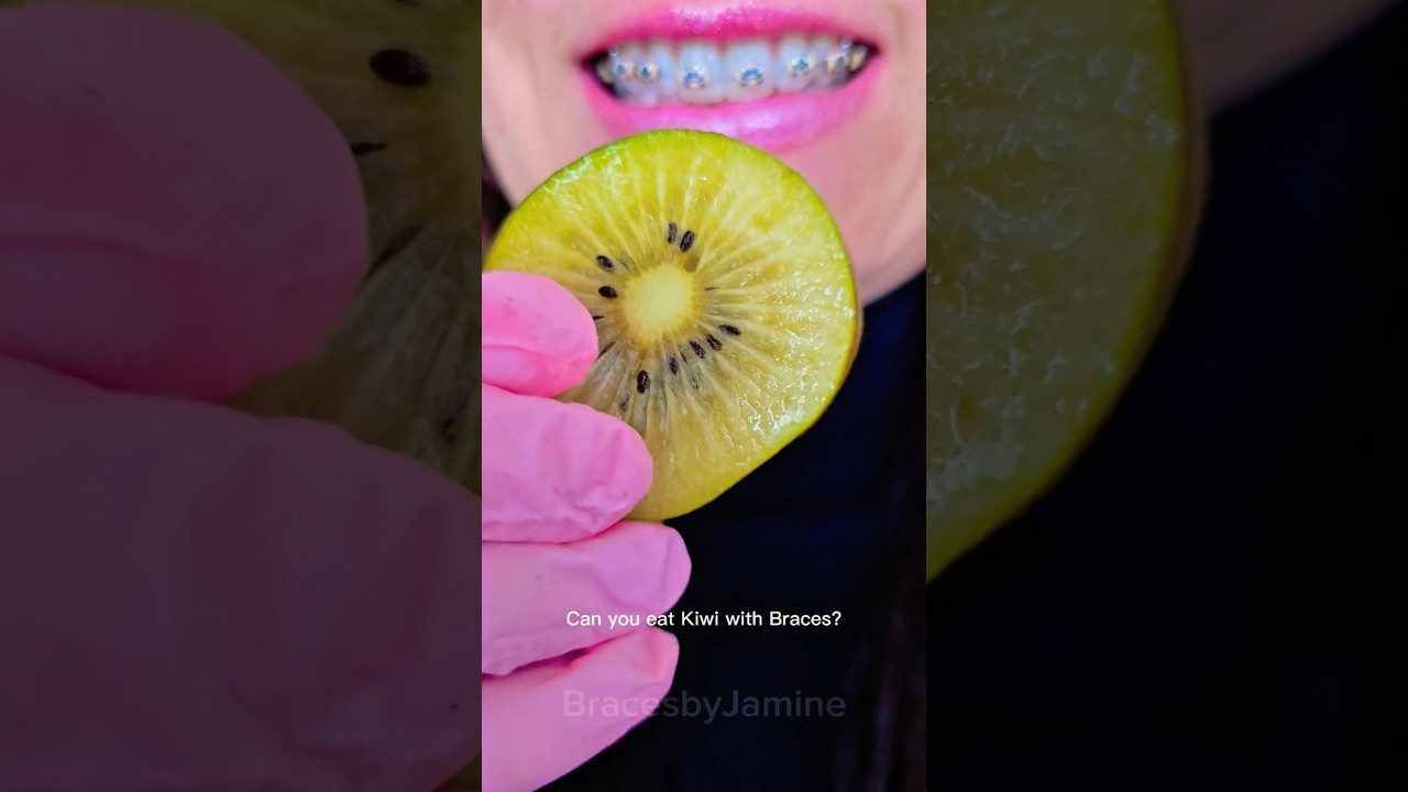 Can you eat Kiwi with Braces?  #shorts #braces