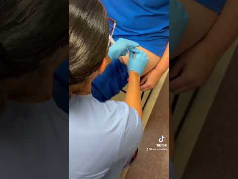 Vastus Lateralis Injection