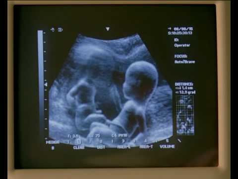 Teka Eco, Music by Minus 8