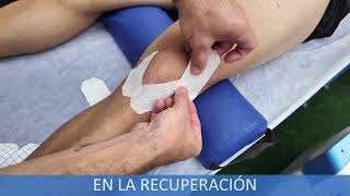 Fisioterapia deportiva