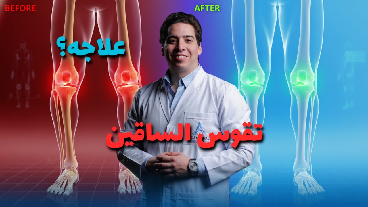 جراحات الكتف المتقدمة