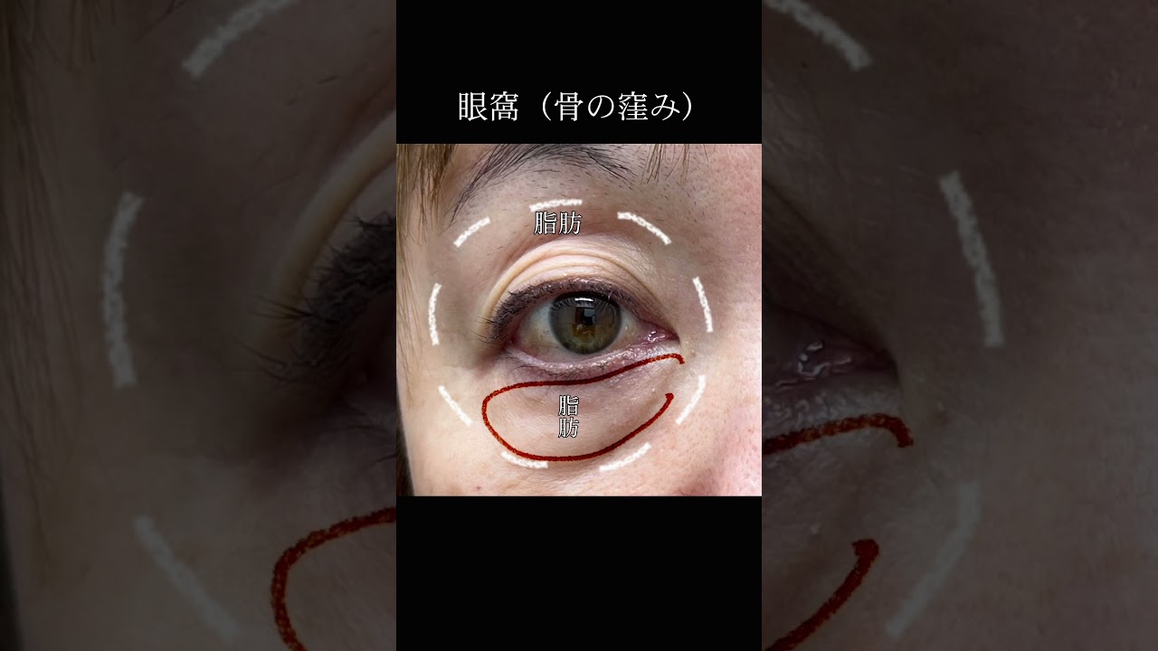 Youtubeのサムネイル