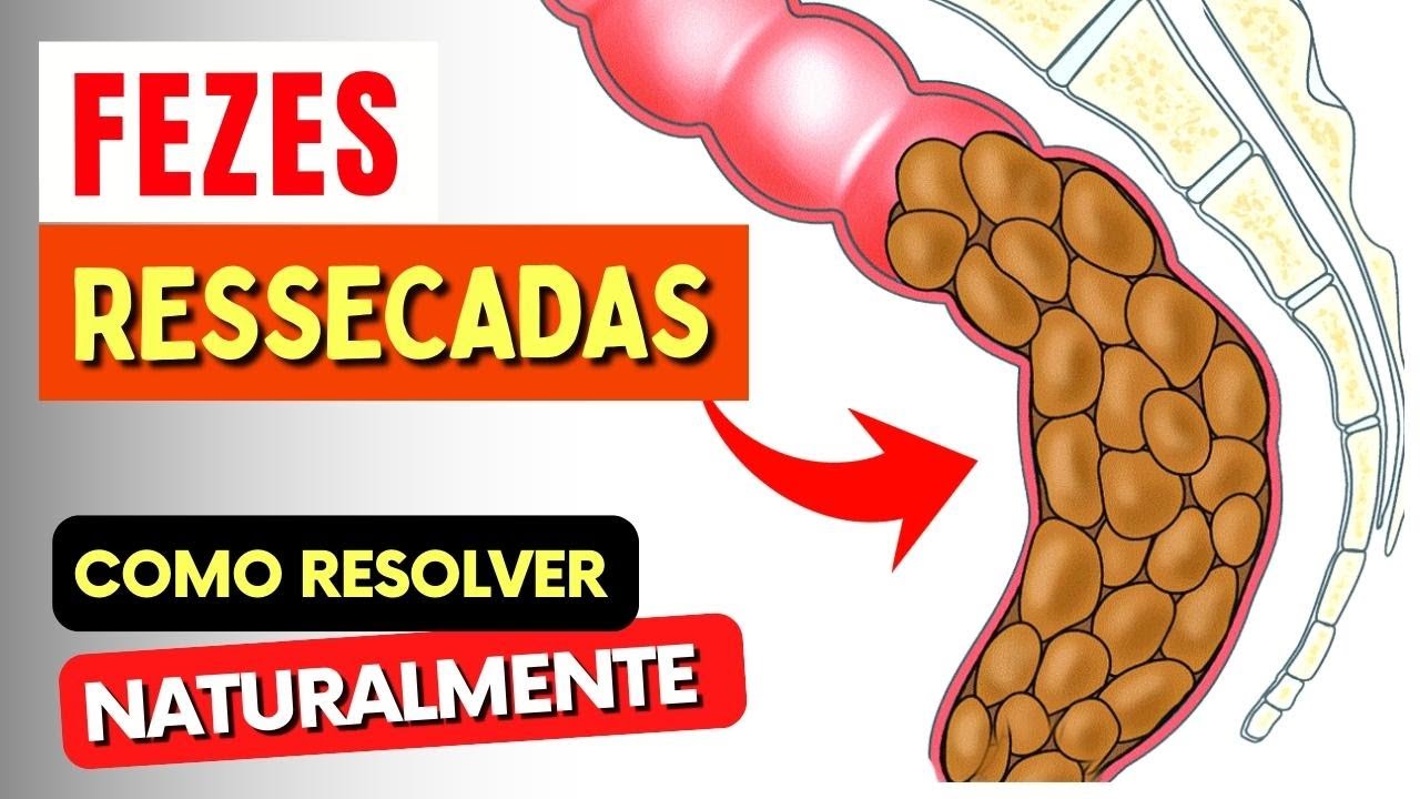 FEZES RESSECADAS e Intestino Preso - Como Resolver NATURALMENTE!