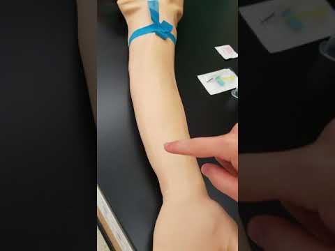 Phlebotomy: The Veins Used for Venipuncture
