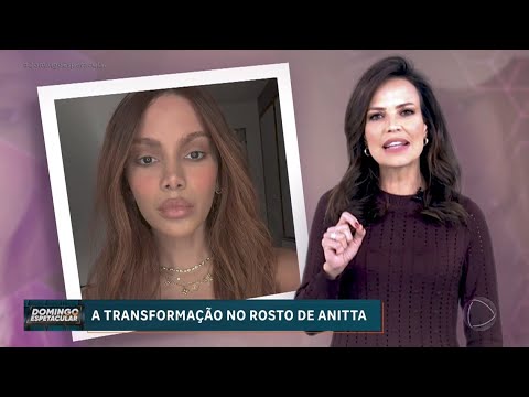 A Transformação No Rosto de Anitta (Domingo Espetacular) [HD]