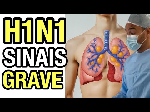 FIRST Symptoms of H1N1 Flu | H1N1 Flu