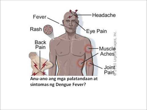 Kung lamang para sa almusal kung maaari kang mawalan ng timbang Ehersisyo ng kamay pagbaba ng timbang video