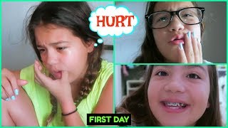 BRACES HURT &quot;MY FIRST FULL DAY &quot; ALISSON