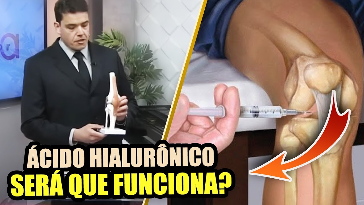 INFILTRAÇÃO COM ÁCIDO HIALURÔNICO FUNCIONA? - Novidades no tratamento da ARTROSE