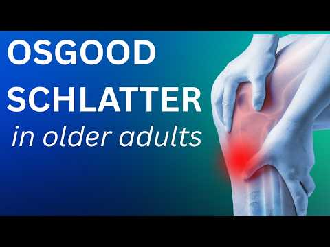 Osgood-Schlatter-Syndrom bei Erwachsenen | Knieschmerzen | Behandlungsmöglichkeiten (Physiotherap...