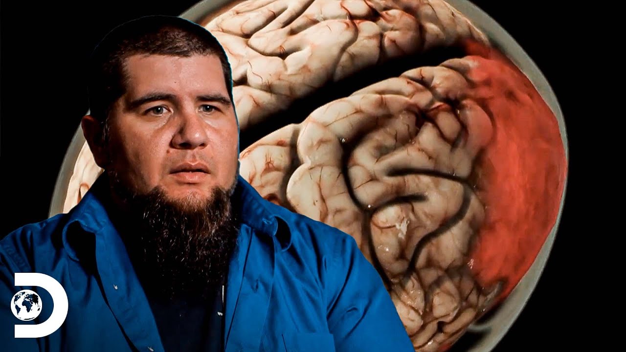 Um vulto de água no cérebro | Parasitas Assassinos | Discovery Brasil