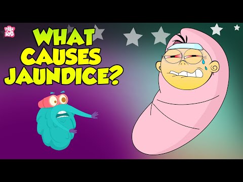 Jaundice | Causes of Jaundice | The Dr Binocs Show | Peekaboo Kidz