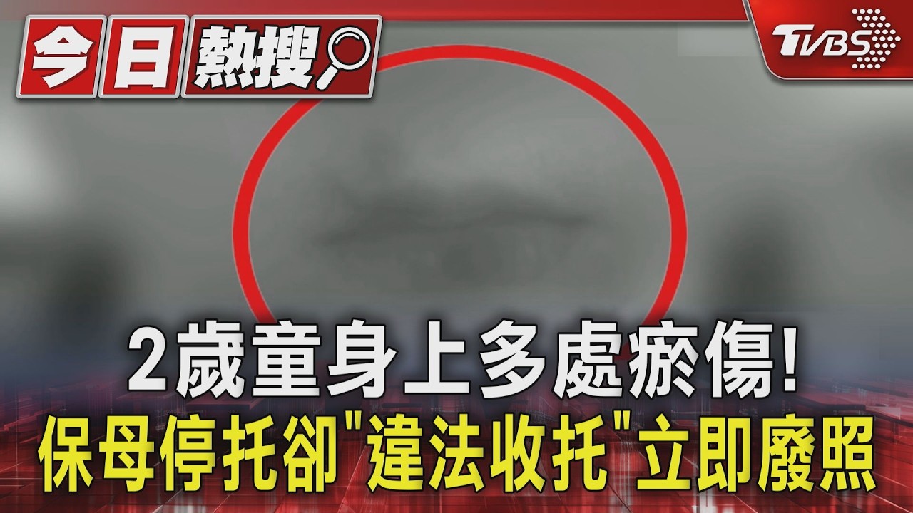影音／2歲童身上多處瘀傷！　保母停托卻「違法收托」立即廢照