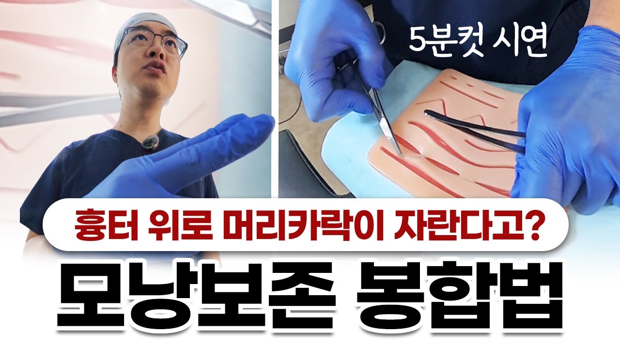 모발이식 후 흉터 최소화 봉합법 | 문건학 대표원장vs일반인