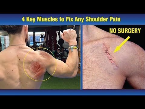Fix Shoulder Pain & Tears with 4 Targeted Exercises - (COMPLETELY AVOID SURGERY!)