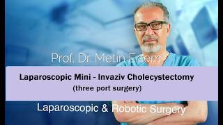 Miniaturka - Laparoscopic (MiniLap) mini invaziv Cholecystectomy. Metin Ertem.MD.FACS