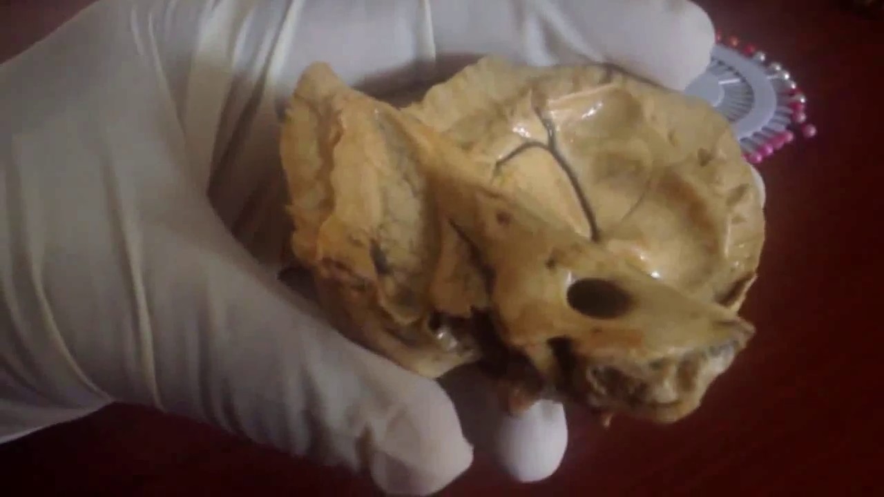 Anatomía - Práctica de Hueso Temporal (Escama, Peñasco, Hueso Timpánico)