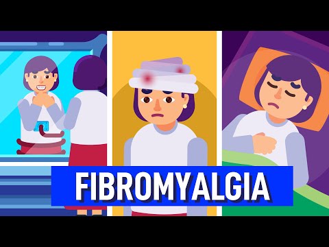Explaining Fibromyalgia