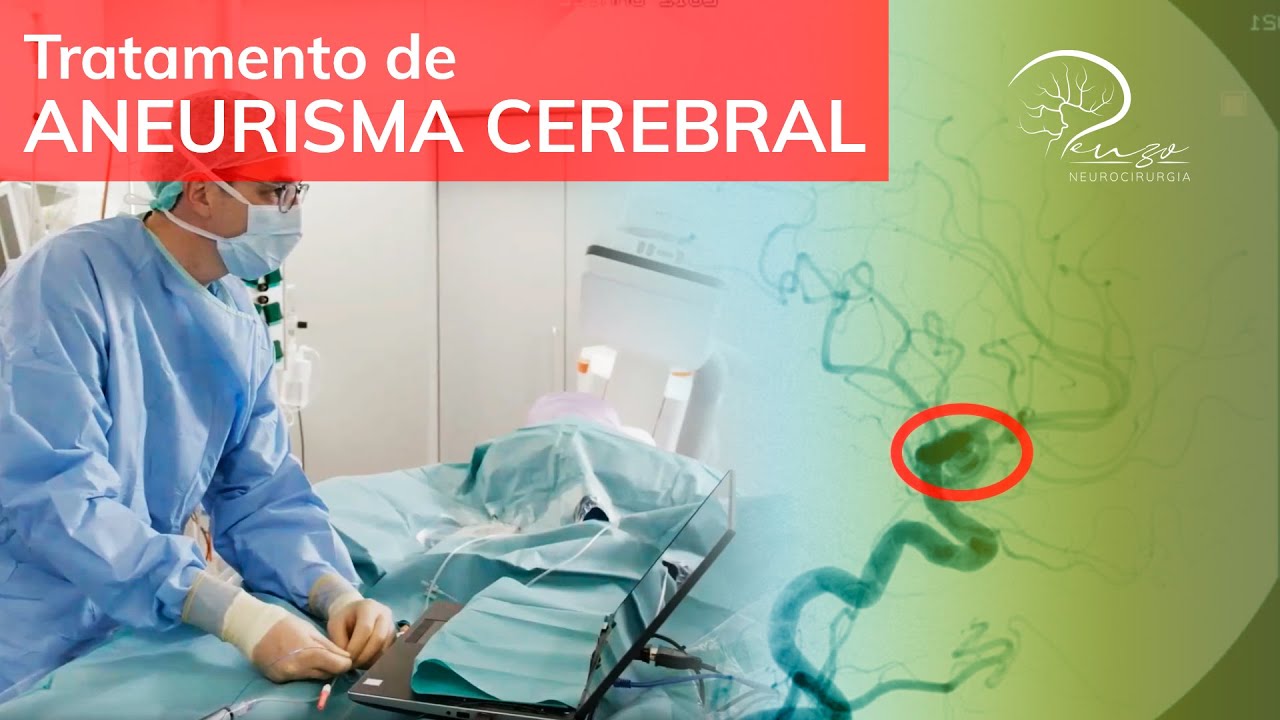 Tratamento de Aneurisma Cerebral - Dr Luiz Penzo