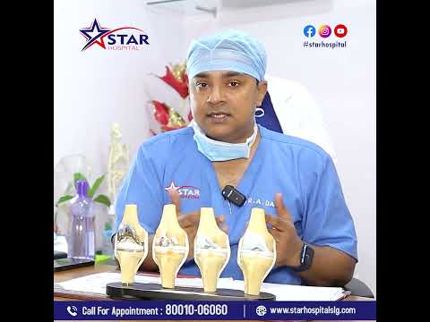 Knee Replacement Surgery || Star Hospital