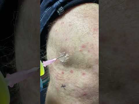 Watch Dr. Kamajian on YouTube