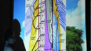 24) Dr Sherif Zaki 20/11/2014 [Thyrocervical trunk- Lateral vertebral muscle - Sterno mastoid ]