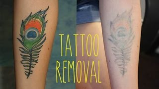 hmongbuy net dr tattoff tattoo removal vlog 5 hmongbuy net dr tattoff tattoo removal vlog 5