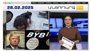 Շունը պատառոտել է 9-ամյա երեխայի դեմքը