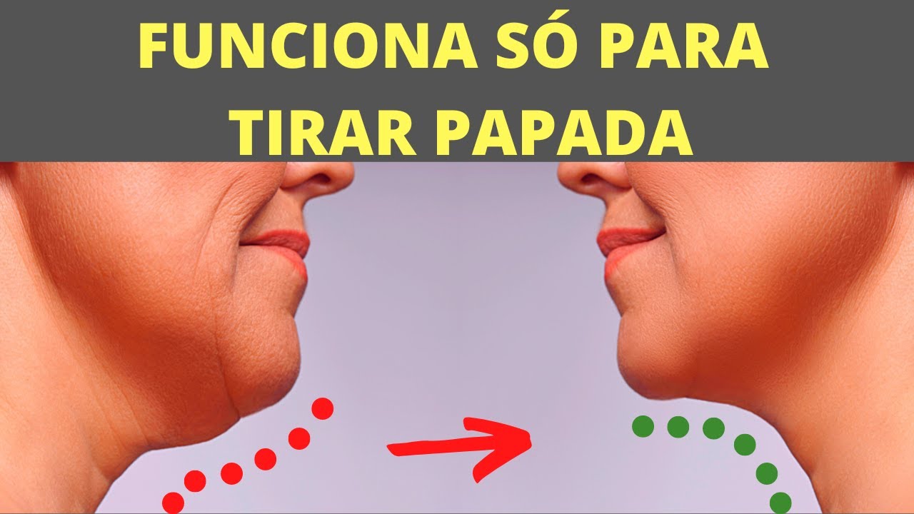 Como ELIMINAR Gordura e Flacidez da PAPADA + SOLUÇÃO para FIBROSE de PAPADA
