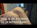 Wat is de knobbel op je scheenbeen? | Vragen van kinderen | Het Klokhuis