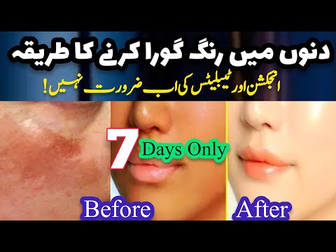 Rang Gora Karne Ka Tarika | 7 Din Mein Rang Gora Karne Ki Cream | Dr Hamed Shaafi | ARZOO